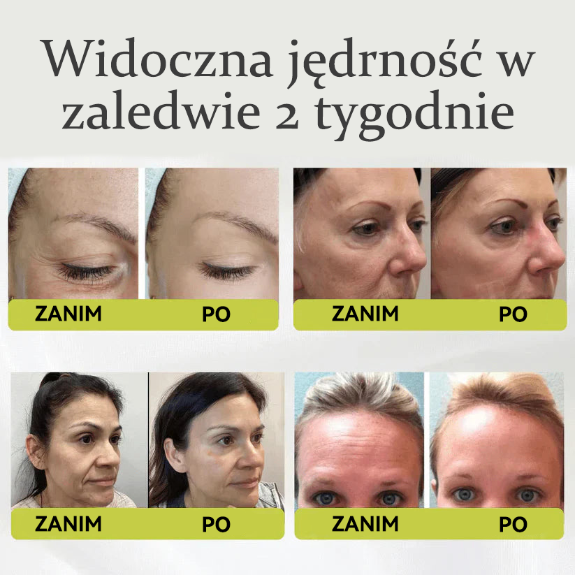 👏🌿Dumnie opracowane i zatwierdzone przez polskie instytucje💫Tiworld® Zaawansowany krem liftingująco-odnawiający z peptydami o działaniu podobnym do botoksu + retinolem Vita-A – tylko dziś 70% zniżki