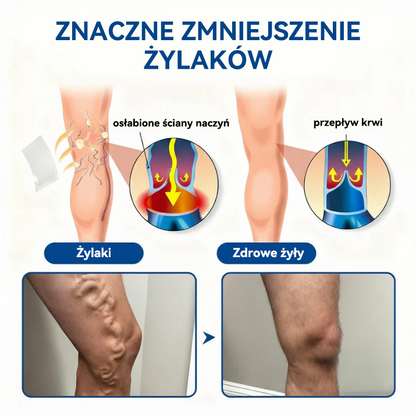🎖️🇵🇱👨‍⚕️✅TAILEDEN® VeinEase Plastry z Mikronakłuciami⚡Natychmiastowa ulga, długotrwałe rezultaty.z