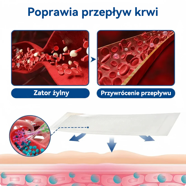 🎖️🇵🇱👨‍⚕️✅TAILEDEN® VeinEase Plastry z Mikronakłuciami⚡Natychmiastowa ulga, długotrwałe rezultaty.z