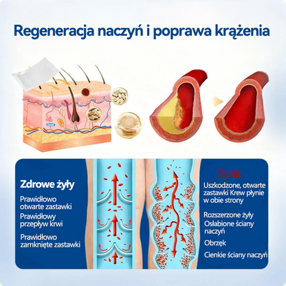 🎖️🇵🇱👨‍⚕️✅TAILEDEN® VeinEase Plastry z Mikronakłuciami⚡Natychmiastowa ulga, długotrwałe rezultaty.z